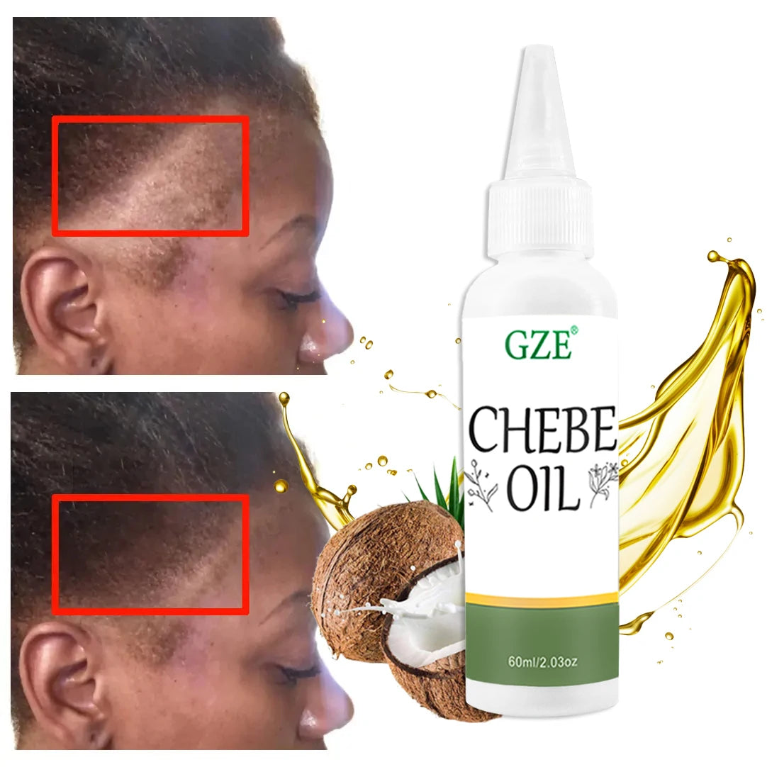 GZE Chebe Hair Oil Made with Chebe Powder - African Chebe Oil for Hair Thickens & Strengthens, Itchy Scalp Relief - Moyo Elikia