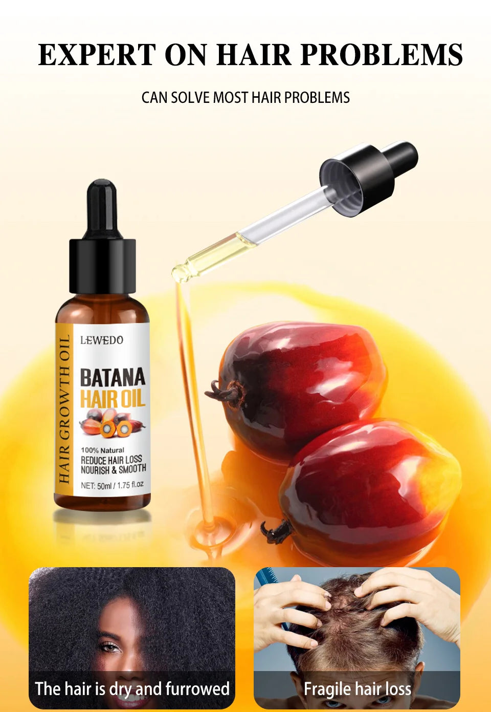 Fast Hair Growth Oil Africa Crazy Traction Alopecia batana Hair Mask Anti Hair Break Hair Strengthener Hair Loss Treatment Spray - Moyo Elikia