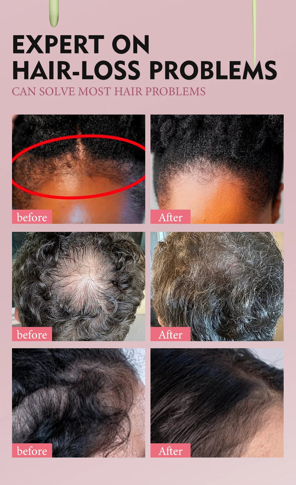 100% Pure Natural Karkar Chebe Oil Batana Butter Hair Growth Oil Rosemary Repair Damaged Hair Treatment Oil Anti-Hair Loss Care - Moyo Elikia