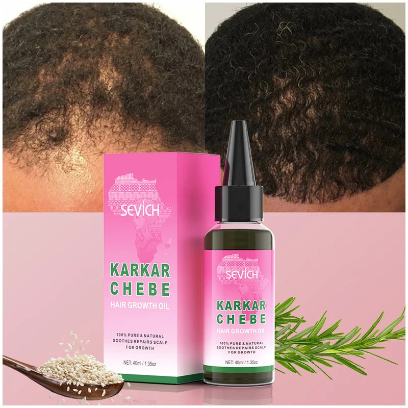 100% Pure Natural Karkar Chebe Oil Batana Butter Hair Growth Oil Rosemary Repair Damaged Hair Treatment Oil Anti-Hair Loss Care - Moyo Elikia