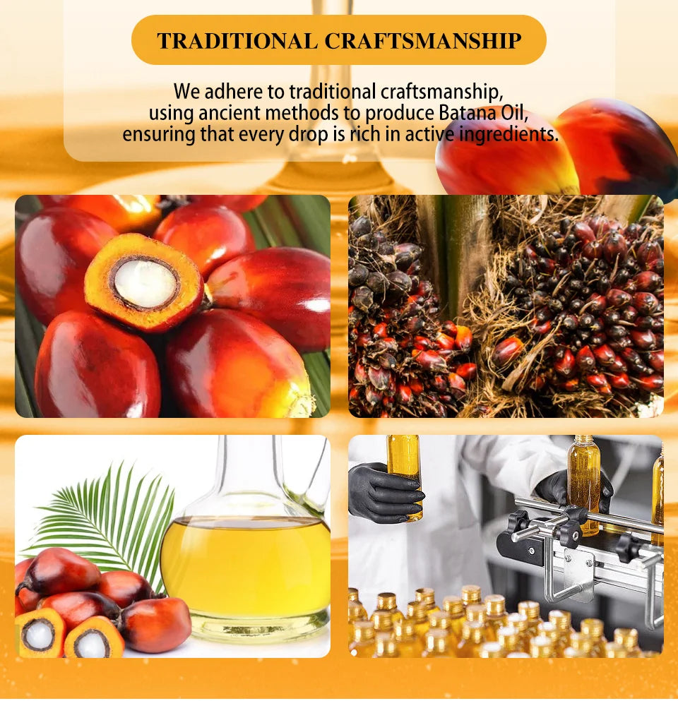 Fast Hair Growth Oil Africa Crazy Traction Alopecia batana Hair Mask Anti Hair Break Hair Strengthener Hair Loss Treatment Spray - Moyo Elikia