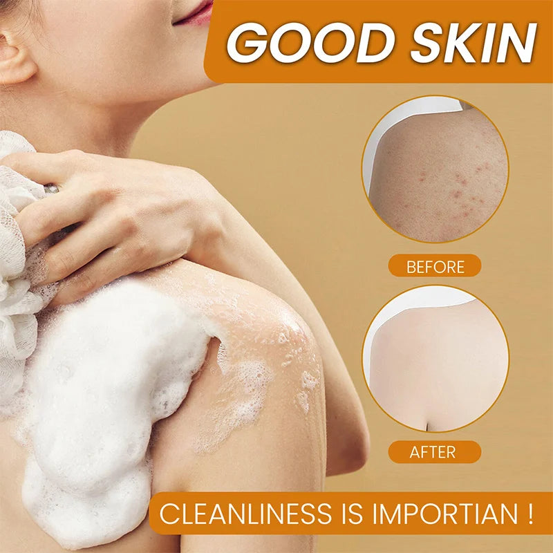 Turmeric Body Care Soap Soap Clean And Removing Skin Grease Control Oil Intake Prevent Dry Skin Toilet Soap Body Care Products - Moyo Elikia