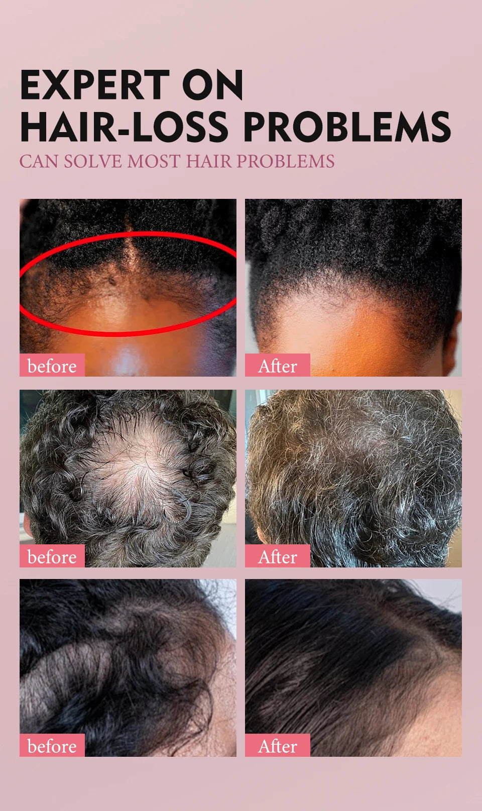 100% Pure Natural Karkar Chebe Oil Batana Butter Hair Growth Oil Rosemary Repair Damaged Hair Treatment Oil Anti-Hair Loss Care - Moyo Elikia