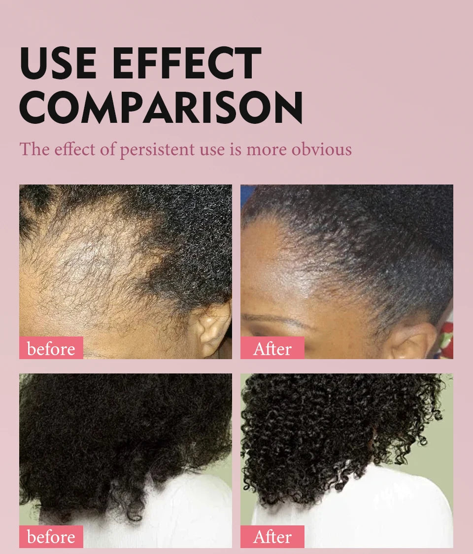 100% Pure Natural Karkar Chebe Oil Batana Butter Hair Growth Oil Rosemary Repair Damaged Hair Treatment Oil Anti-Hair Loss Care - Moyo Elikia