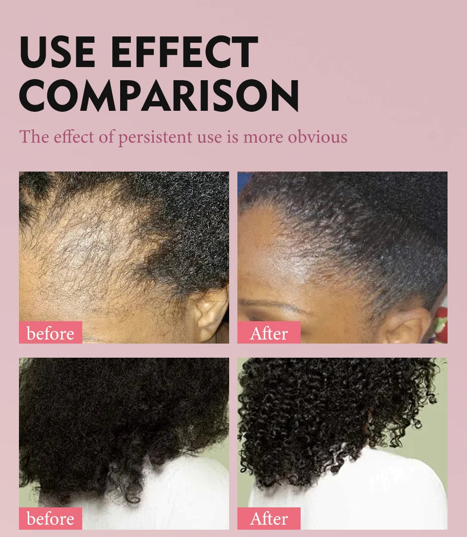 100% Pure Natural Karkar Chebe Oil Batana Butter Hair Growth Oil Rosemary Repair Damaged Hair Treatment Oil Anti-Hair Loss Care - Moyo Elikia