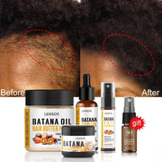 Fast Hair Growth Oil Africa Crazy Traction Alopecia batana Hair Mask Anti Hair Break Hair Strengthener Hair Loss Treatment Spray - Moyo Elikia