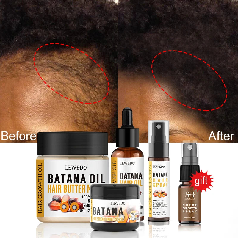 Fast Hair Growth Oil Africa Crazy Traction Alopecia batana Hair Mask Anti Hair Break Hair Strengthener Hair Loss Treatment Spray - Moyo Elikia