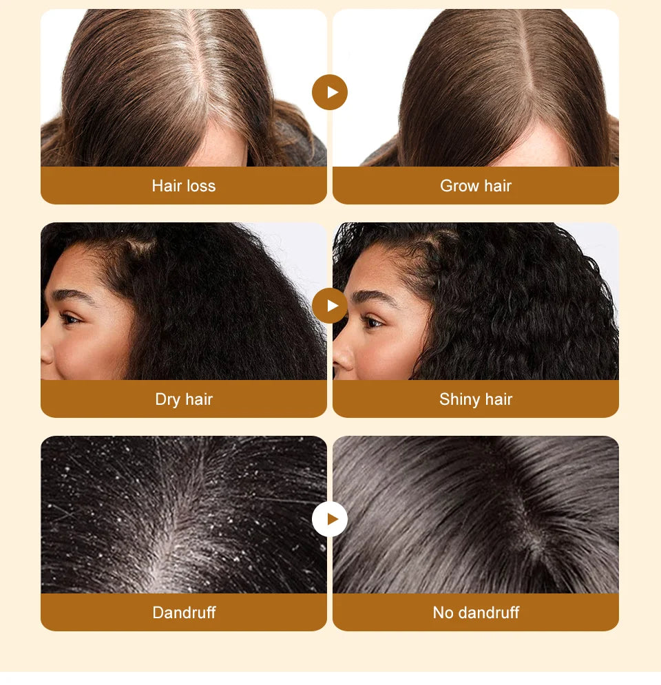 Fast Hair Growth Oil Africa Crazy Traction Alopecia batana Hair Mask Anti Hair Break Hair Strengthener Hair Loss Treatment Spray - Moyo Elikia