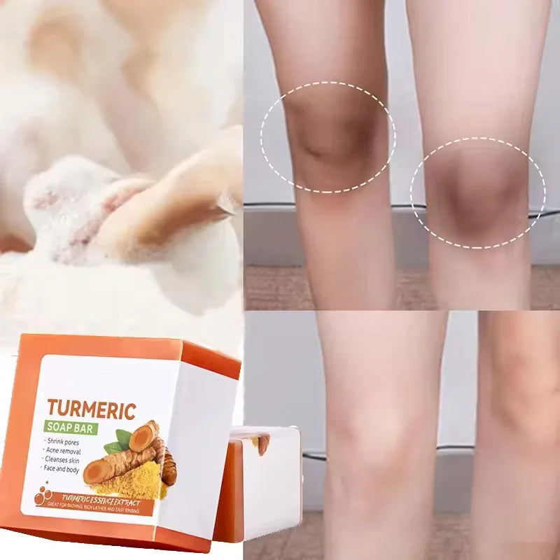 Natural Turmeric Soap Body Cleaning Lightening Dark Underarm Leg Bath Cleansers Brightening Face Soap Tender Skin Care Beauty - Moyo Elikia