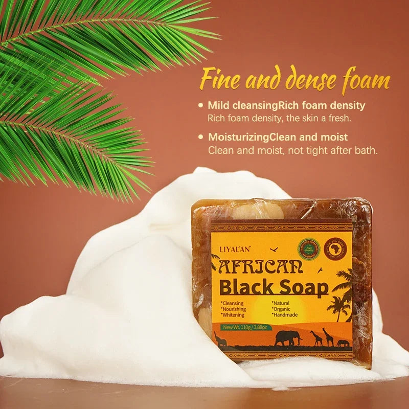 100g Natural African Black Soap With Organic Shea Butter Anti Rebelles Treatment Acne Moisturizing SkinCare Handmade Body Bath - Moyo Elikia