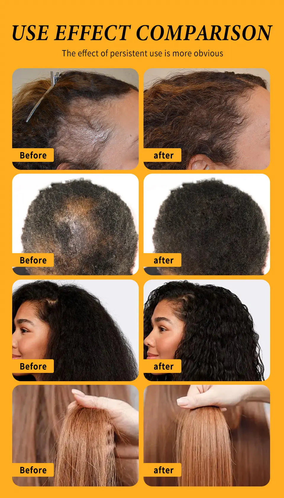Fast Hair Growth Oil Africa Crazy Traction Alopecia batana Hair Mask Anti Hair Break Hair Strengthener Hair Loss Treatment Spray - Moyo Elikia