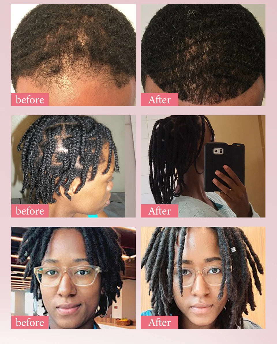 100% Pure Natural Karkar Chebe Oil Batana Butter Hair Growth Oil Rosemary Repair Damaged Hair Treatment Oil Anti-Hair Loss Care - Moyo Elikia