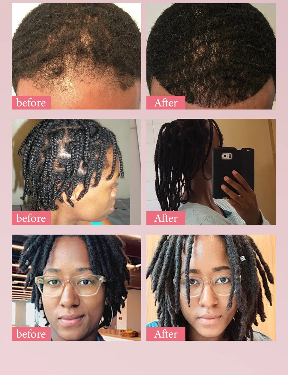 100% Pure Natural Karkar Chebe Oil Batana Butter Hair Growth Oil Rosemary Repair Damaged Hair Treatment Oil Anti-Hair Loss Care - Moyo Elikia