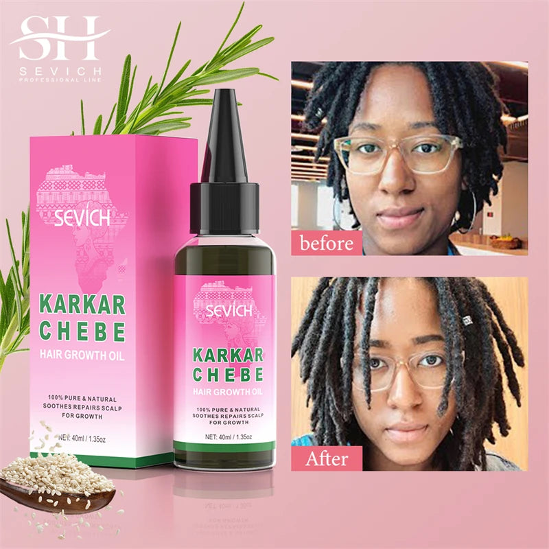SEVICH Chebe Fast Hair Growth Oil And Scalp Massager Comb Tool Set Karkar Oil Scalp Hair Strengthening Serum Hair Growth Product - Moyo Elikia