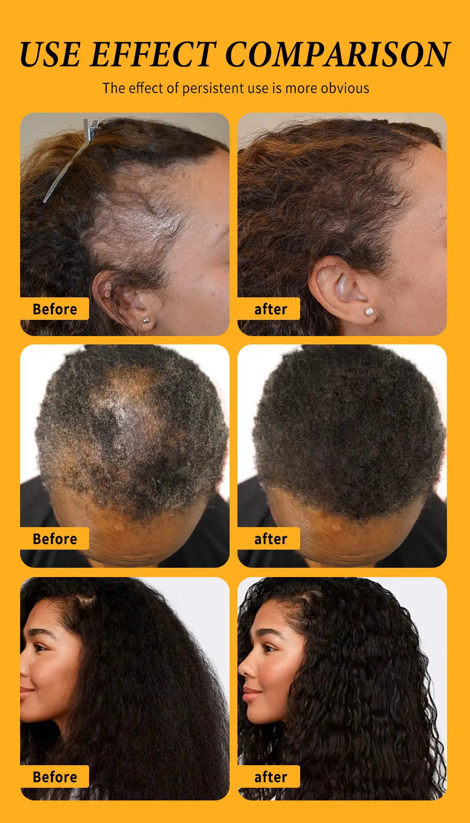 Fast Hair Growth Oil Africa Crazy Traction Alopecia batana Hair Mask Anti Hair Break Hair Strengthener Hair Loss Treatment Spray - Moyo Elikia
