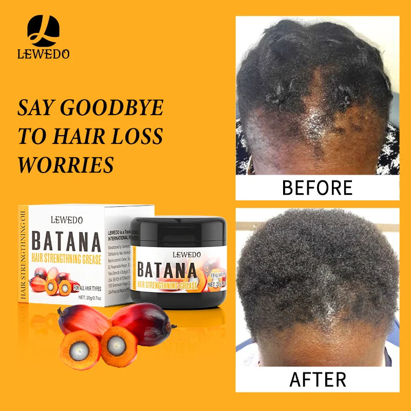 Fast Hair Growth Oil Africa Crazy Traction Alopecia batana Hair Mask Anti Hair Break Hair Strengthener Hair Loss Treatment Spray - Moyo Elikia