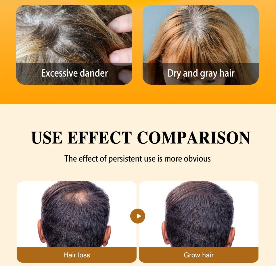 Fast Hair Growth Oil Africa Crazy Traction Alopecia batana Hair Mask Anti Hair Break Hair Strengthener Hair Loss Treatment Spray - Moyo Elikia