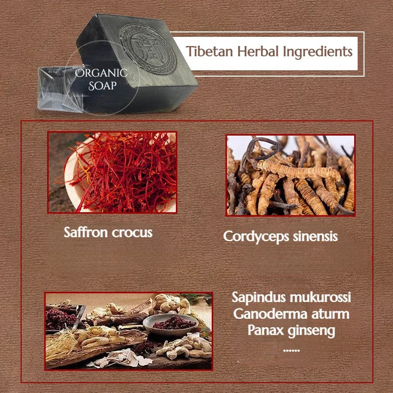 Tibetan Ancient Soap Black Soap Handmade Soap Face Clean Anti-Acne Remove Blackheads Chinese Herbal Soap with Cordyceps Sinensis - Moyo Elikia